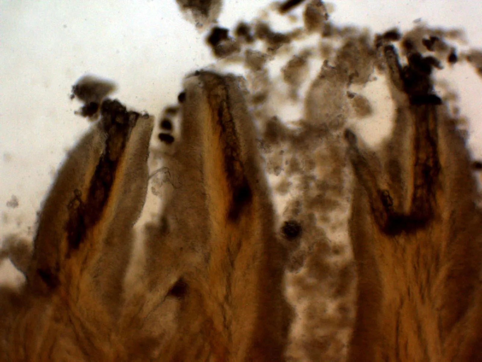 Microscopía de Mycoaciella efibulata - 11 - Cristalizaciones subhimeniales KOH x 100
